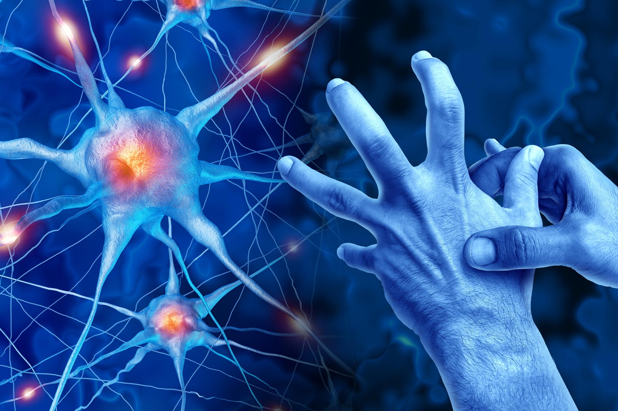 Parkinson's Disease
